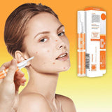 15ml Anti-Freckle Cream Vitamin C Whitening Freckle Serum Instant Blemish Removal Gel